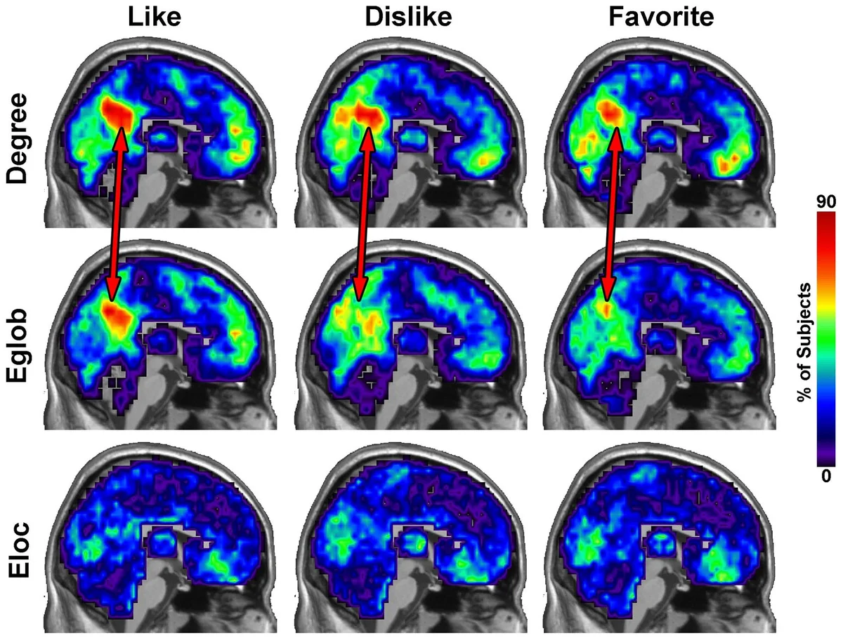 brain listening to music neural activity fMRI